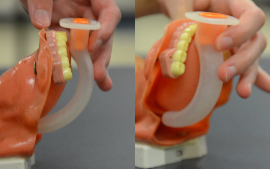 Insert an Oropharyngeal Airway