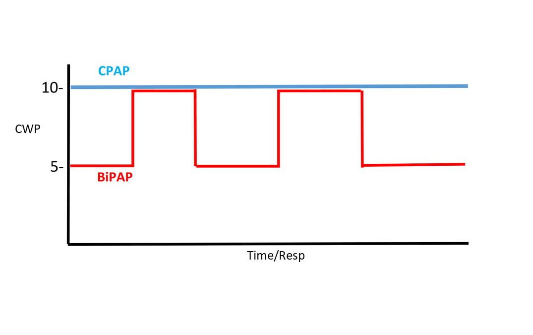 Essentials of BiPAP